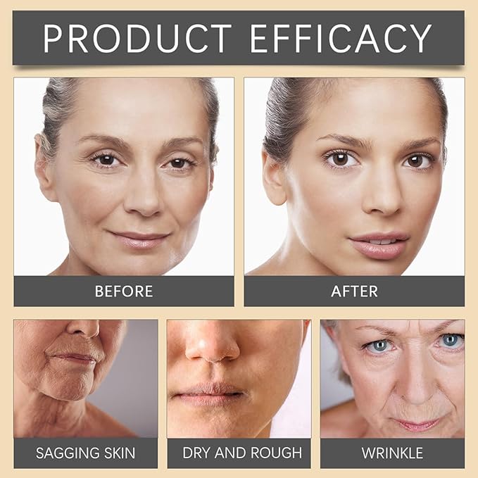 Bee Venom Moisturiser Cream Wrinkle Removal & Firming, Anti-Aging Eye&Face Bee Venom Skin Treatment Cream, Natural And Non-Irritating, Lifting & Recovery For All Skin Type (1 Pack, 20g)