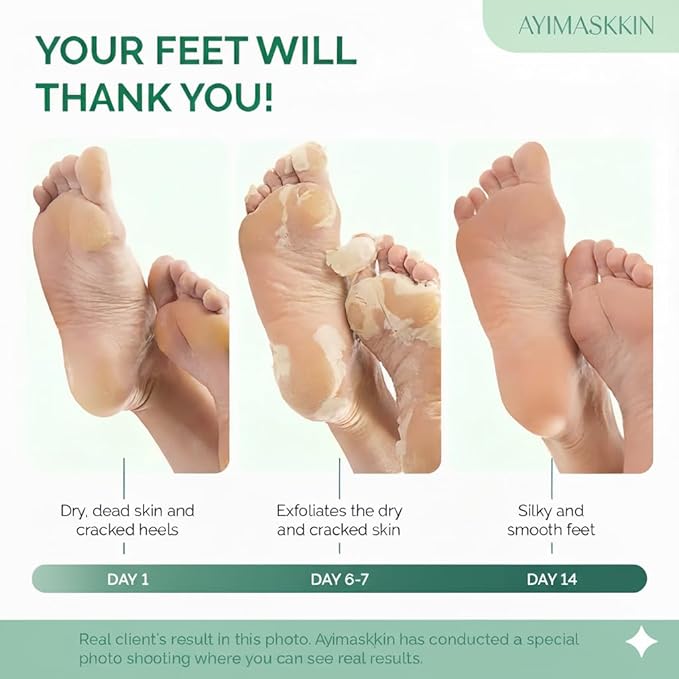 Peeling Foot Mask 3 Pack | Lavender Extract Foot Peel for Dead Skin Removal & Heel Repair | Dermatologically Tested