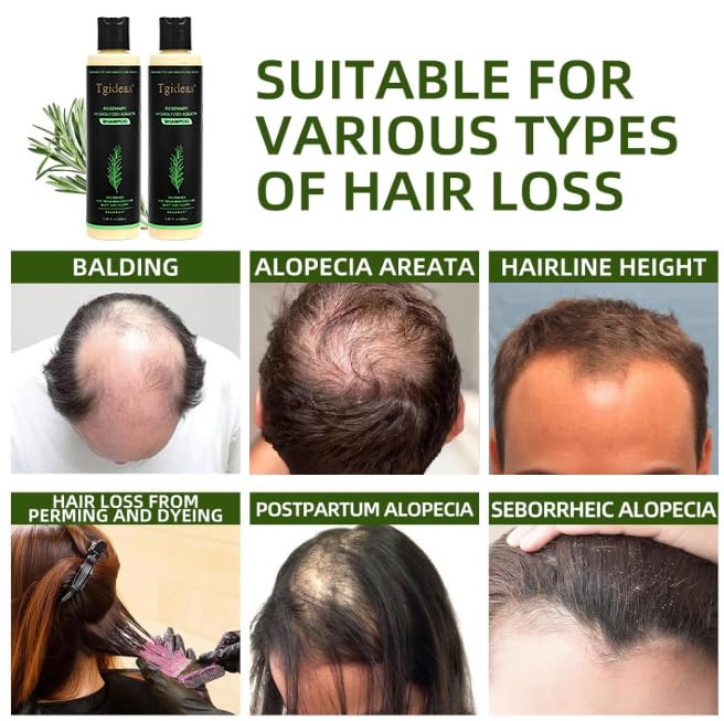 Tgideas Organic Rosemary Hair Growth Shampoo for Women and Men-Natural Thickening & Strengthening Shampoo with Hydrolyzed Keratin for Thinning Hair & Hair Loss 7.4 fl.oz