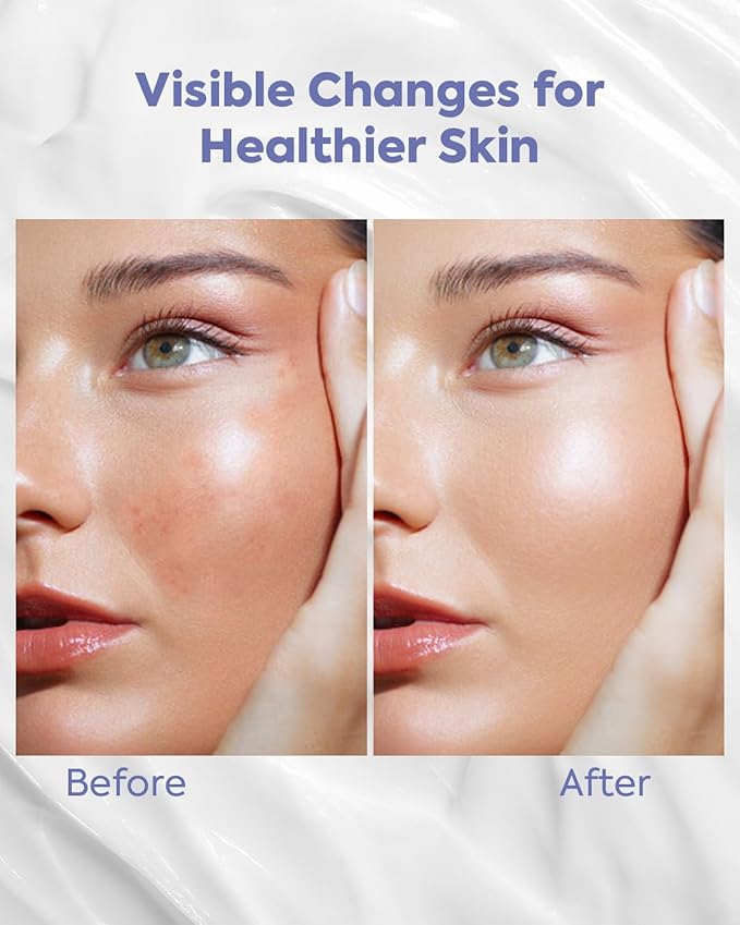 KOMFYMED Hydrating Essence Emulsion – Hyaluronic Acid Face Lotion for Sensitive Skin, Ultra-Lightweight Daily Moisturizer to Soothe Dry & Dehydrated Skin (2.7 Fl. Oz./80mL)
