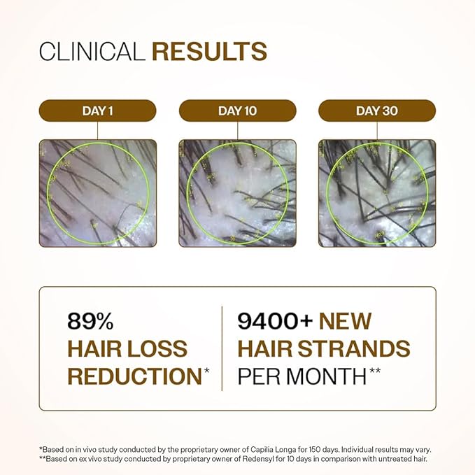 Bare Anatomy Advanced Hair Density Serum | 3% Redensyl, 4% Anagain, 3% Baicapil, 1% Capilia Longa, Rosemary, Biotin & Rice Extract | Reduces Hair Fall, Supports Hair Growth for Men & Women | 30 ml