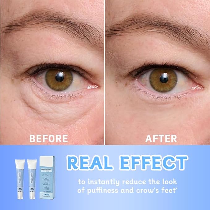 Instant Firming Eye Serum,Visibly Reduces Under-Eye Bags, Wrinkles, Dark Circles, Fine Lines & Crow's Feet Instantly,Anti-Aging Formula for Under Bags and Wrinkles,10ml（2PCS）