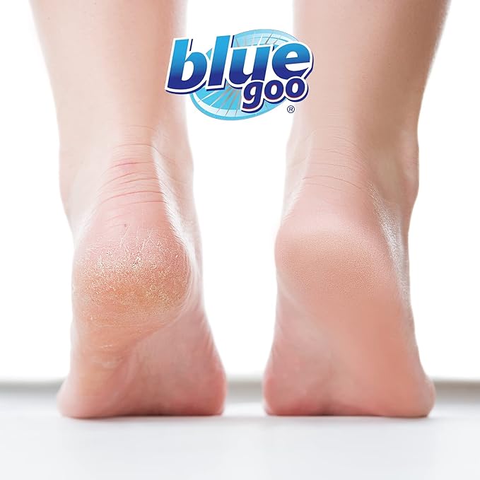 Blue Goo Cracked Heels & Dry Hands Skin Protectant, Helps Relieve & Protect Cracked Skin, OTC Lanolin Formula, 2 oz (2 Pack), Made with Emu Oil & Beeswax