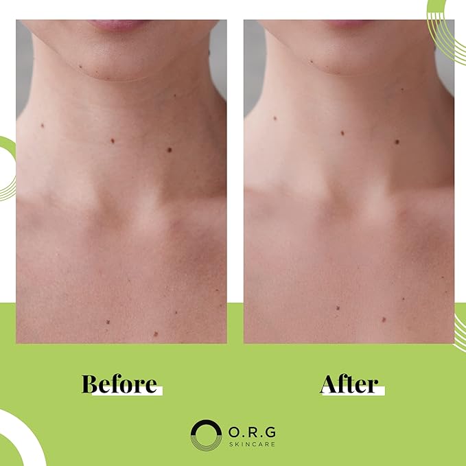 ORG Body Scrub Deep Gel Exfoliator for Glowing and Smooth Skin - Korean Exfoliating Peel Skincare - Natural Cruelty Free Formulation for Sensitive Skin 6oz