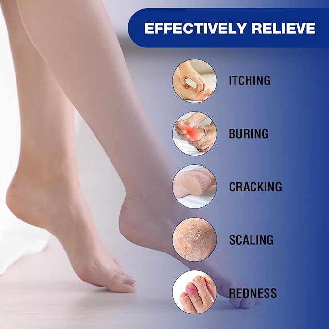 Foot Cream for Cracked Heels Cream - Extra Strength for Cracked Heels, Dry Skin & Itchy Feet – Soothes Burning, Scaling & Irritation for Men and Women