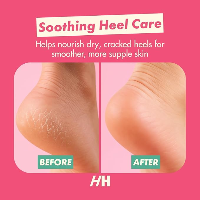 Handmade Heroes Foot Mask for Cracked Heel Treatment Gel Mask for Dry Cracked Feet Women with Jojoba & Vitamin E Intensive Overnight Heel Repair Moisturizing Overnight 2pc