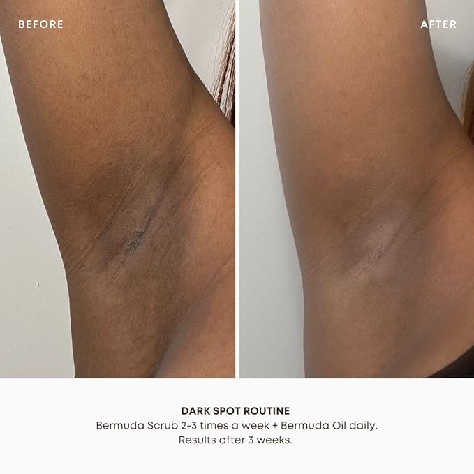 Bushbalm Dark Spots and Ingrown Hair 2 Step Routine - Rejuvenate and Nourish - Ingrown Hair Oil (30 ml) and Exfoliating Scrub (236 ml) - Bermuda