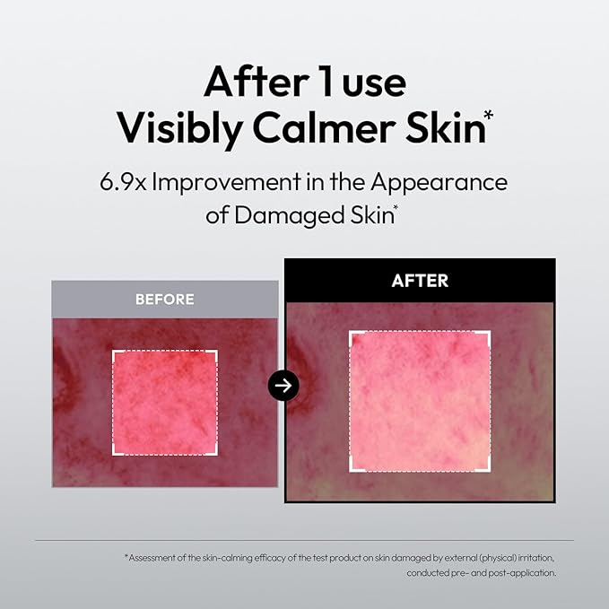 LAYERLAB Barrier Boost Serum with 5% Panthenol 4% Niacinamide, Soothing Korean Skincare for Sensitive Skin, Niosome Panthenol Serum, 30ml, 1.01 fl.oz.