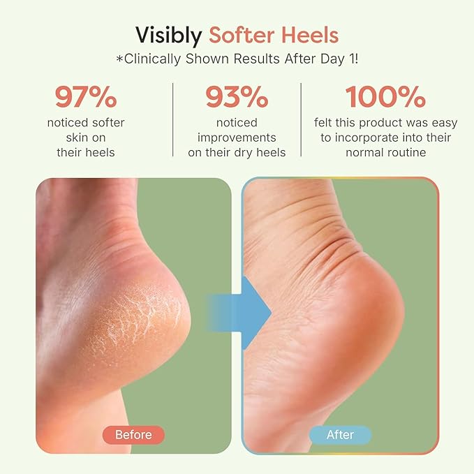 ZenToes Moisturizing Socks for Cracked Heel Treatment, Vitamin E, Olive Oil and Jojoba Oil Infused Heel Socks, Spa Gifts for Women, Mothers Day Gifts (Fuzzy Mint Green, 1 Pair Regular)