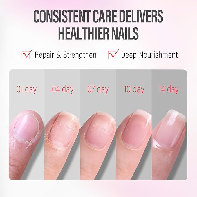 CHUCHU Vegan Cuticle Oil for Nails: Watermelon Jojoba Nail Cuticle Oil with Vitamin B & E for Moisturizes Cuticle and Nail's Skin - Prevents Hangnails and Chapped 15ML