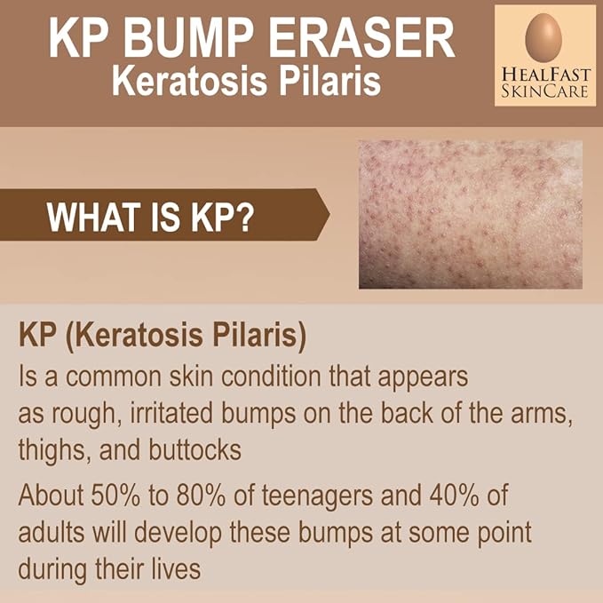 Healfast KP Bump Eraser Cream (4 Oz) and Bodywash (8 Oz) Set – Soften, Exfoliate, Nourish Rough and Bumpy Skin – Keratosis Pilaris - For All Types