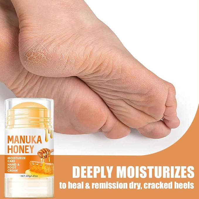 60% Urea Cream - Foot Hand Cream Stick for Dry & Cracked Feet Elbows Knees Heels Hands, Hydrates & Nourish Foot Care for Softening and Moisturizing, Removing Calloused Skin (Manuka Honey, 1.41 oz)