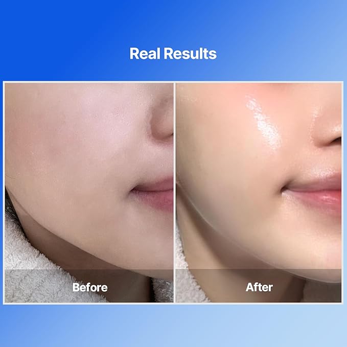 MEDITHERAPY Bluelayer Water Dome Mask - Korean Overnight Collagen Face Mask for Glass Skin, Moisturizing and Firming w/Hyaluronic Acid & Blue Agave - Pore Minimizing Hydrogel Masks Radiant Glow - 4EA