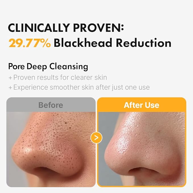 Hanskin Pore Cleansing Oil, Oil Cleanser for Face, Makeup Blackhead Remover, Korean Cleanser for Sensitive Skin (6.76 oz (Pack of 1))