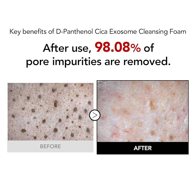 15.5% Panthenol & Cica Exosome | Removes 98% of Pore Impurities | AHA BHA PHA Gentle Exfoliating Wash | Non-Comedogenic | Korean Skincare Cleansing Foam (120ml/4.06 fl.oz.)