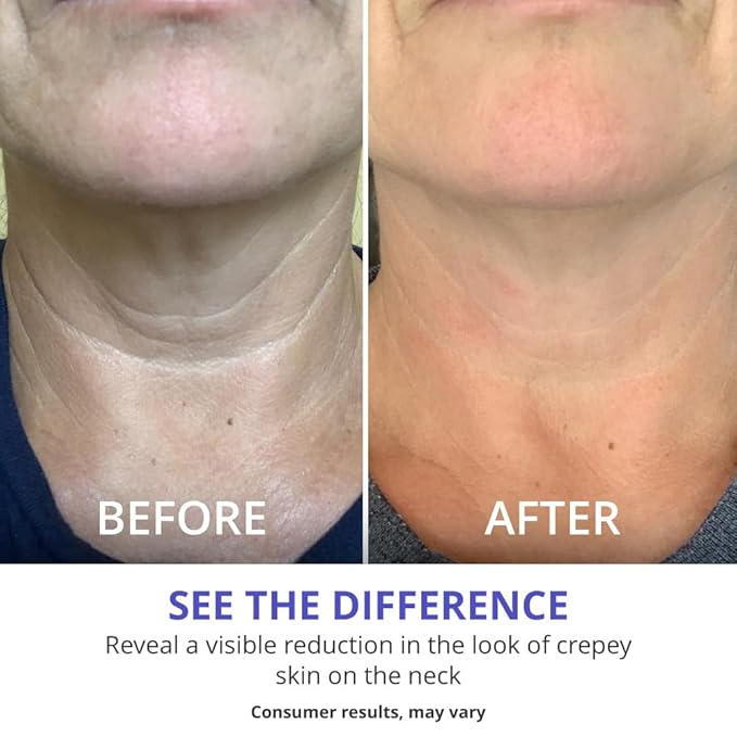 goPure Tighten & Lift Neck & Chest Moisturizer Cream for Visibly Firming, Tightening and Lifting the Look of Wrinkles & Crepey Skin, 1.7oz - Pack of 2