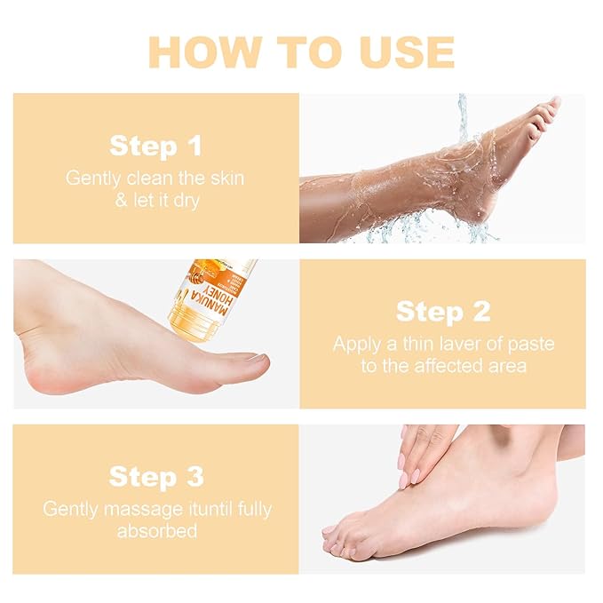 60% Urea Cream - Foot Hand Cream Stick for Dry & Cracked Feet Elbows Knees Heels Hands, Hydrates & Nourish Foot Care for Softening and Moisturizing, Removing Calloused Skin (Manuka Honey, 1.41 oz)