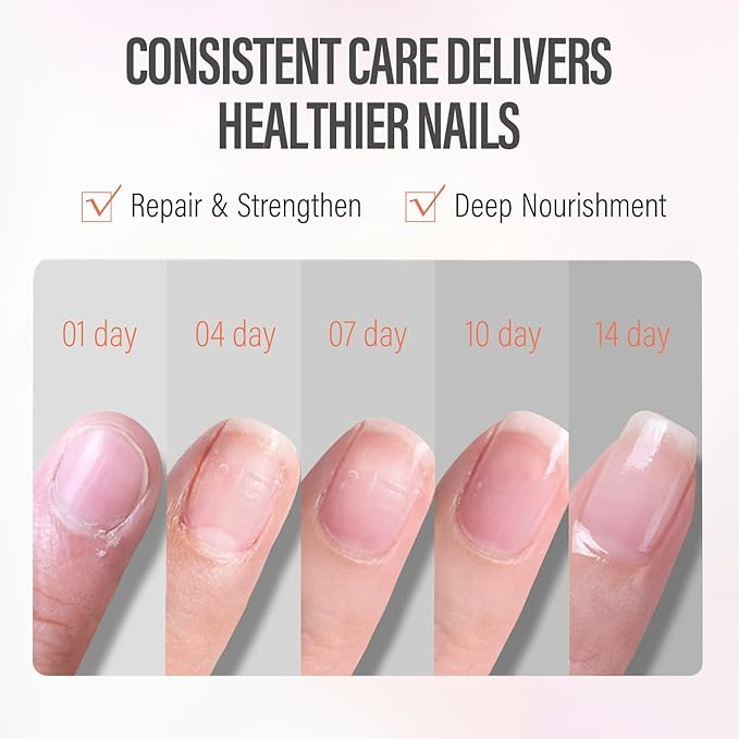 CHUCHU Vegan Cuticle Oil for Nails: Peach Jojoba Nail Cuticle Oil with Vitamin B & E for Moisturizes Cuticle and Nail's Skin - Prevents Hangnails and Chapped 15ML