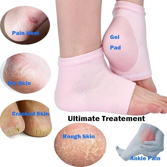 Codream Vented Moisturizing Socks Lotion Gel for Dry Cracked Heels, Spa Gel Socks Humectant Moisturizer Heel Balm Foot Treatment Care Heel Softener Compression (2 Pairs)