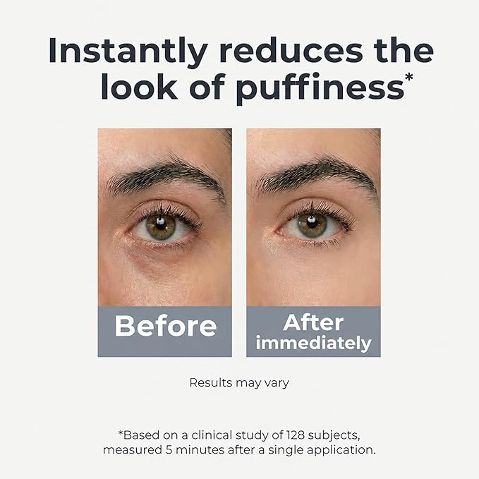 Under Eye Brightener Roller - Caffeine & Retinol Eye Serum for Dark Circles, Puffiness & Fine Lines, Travel Essential Vegan Skincare, Cooling Eye Massage, Dermatologist-Tested, 0.52 fl oz