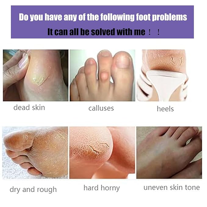 Foot Peel Mask 5 Pack, Exfoliator Peel Off Calluses Dead Skin Callus Remover, Baby Soft Smooth Touch Feet Spa Experience at Home & Gift Ideas - Lavender Scented