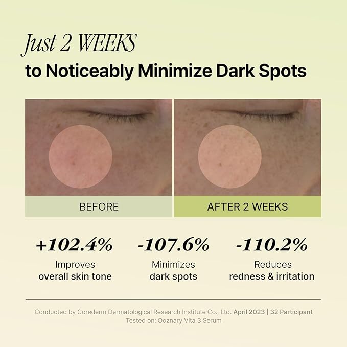 Vita 3 Serum with Vitamin C Derivatives and Niacinamide plus Glutathione for Uneven Skin Tone & Dull Skin | Korean Skin care | 1.69 fl.oz 50ml