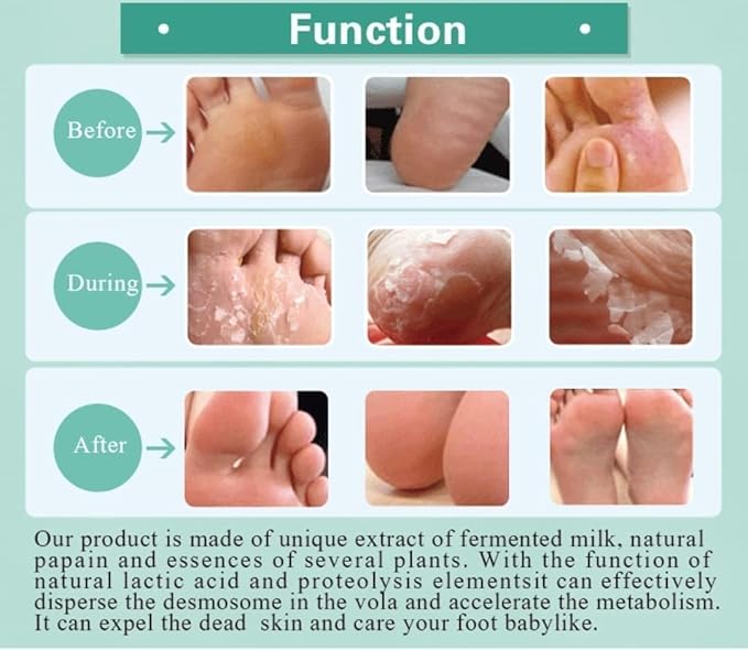 HODAF Foot Peel Mask 2 Pack Peeling Foot Mask - Repairs Heels & Removes Dry Dead Skin Baby Soft Feet - Men Women Exfoliating Foot Peel Mask for Dry Cracked Feet Callous Remover (Lavender)