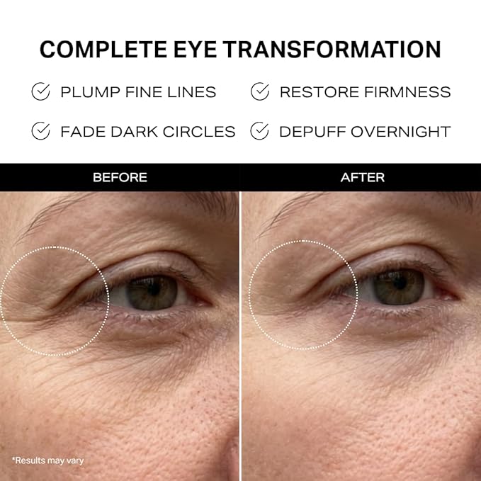 Y'OUR Retinol Collagen Peptide Repair Eye Cream | Firms, Brightens & Depuffs | Cucumber + 3 Collagen-Boosting Peptides + Hyaluronic Acid | For Dark Circles, Fine Lines & Crow's Feet