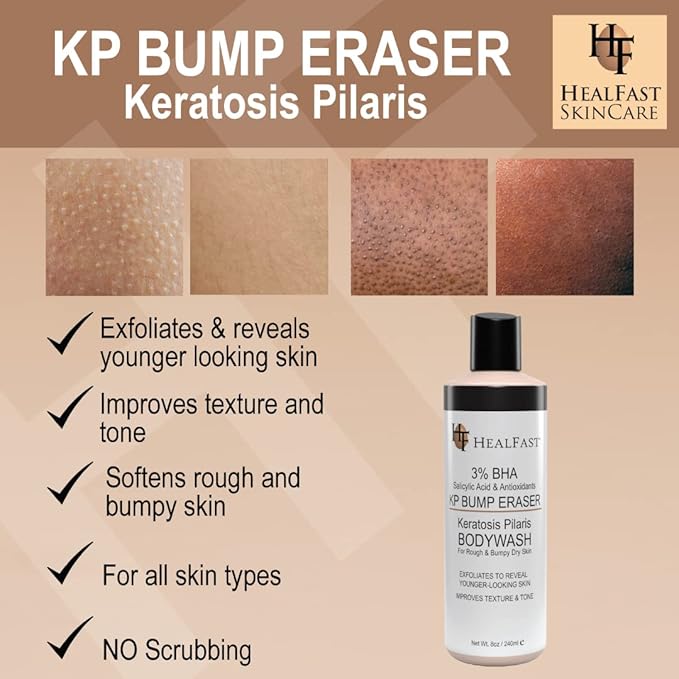 Healfast KP Bump Eraser Cream (4 Oz) and Bodywash (8 Oz) Set – Soften, Exfoliate, Nourish Rough and Bumpy Skin – Keratosis Pilaris - For All Types
