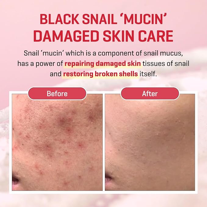 SOME BY MI Snail Truecica Miracle Repair Cream - 2.02Oz, 60ml - Made from Snail Mucin for Sensitive Skin - Daily Repair Face Moisturizer for Acne Marks and Strengthen Skin Barrier - Korean Skin Care