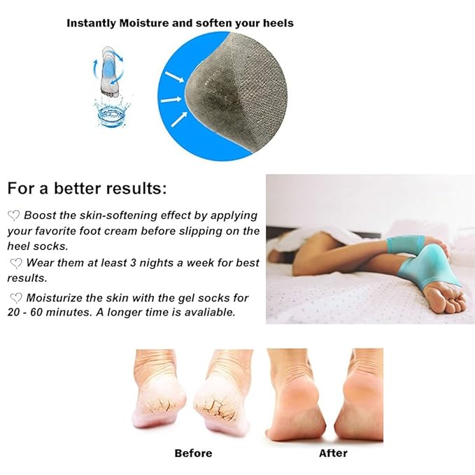 5 Pairs Moisturizing Gel Heel Socks Vented Unisex Toe Open Feet Care Dry Skin