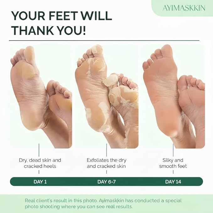Peeling Foot Mask 5 Pack | Lavender Extract Foot Peel for Dead Skin Removal & Heel Repair | Dermatologically Tested