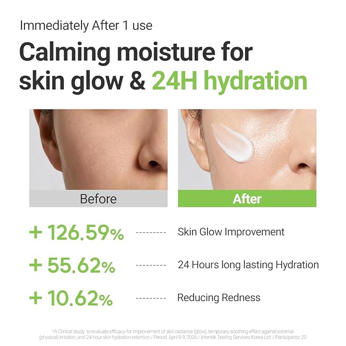ROVECTIN Calming Lotus Cream – Lightweight Hydrating & Soothing Moisturizer Face Cream for Sensitive Skin | 75% Lotus Water Extract & Niacinamide for Anti-Aging | Vegan Korean Skincare (2.03 fl oz)