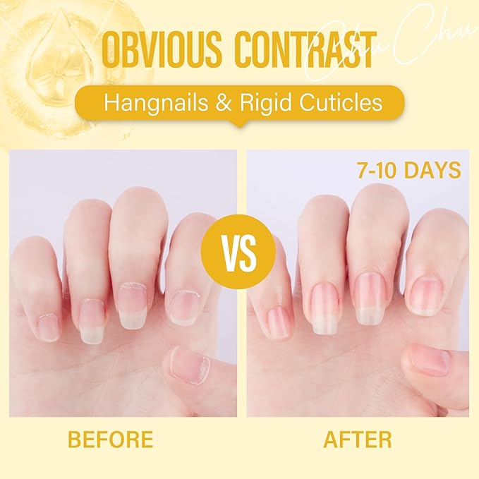 CHUCHU Vegan Cuticle Oil for Nail: Pineapple Scent Natural Vitamin B & E Nail Oil - Hydrates Moisturizes Repairs for Nails Damage Dry Cuticle 0.51 Fl Oz