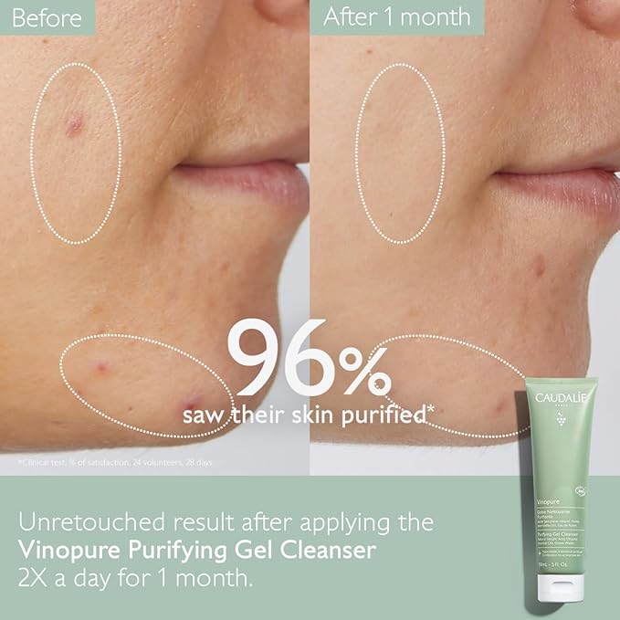 Caudalie Vinopure Salicylic Acid Cleanser, Pore Purifying Gel Cleanser - 150 mL (Pack of 2)