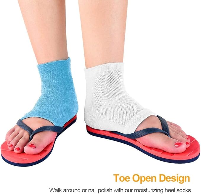 2 Pairs Moisturizing Gel Heel Socks Vented Unisex Day Night Toe Open Feet Care Dry Skin (2P_BlueWhite)