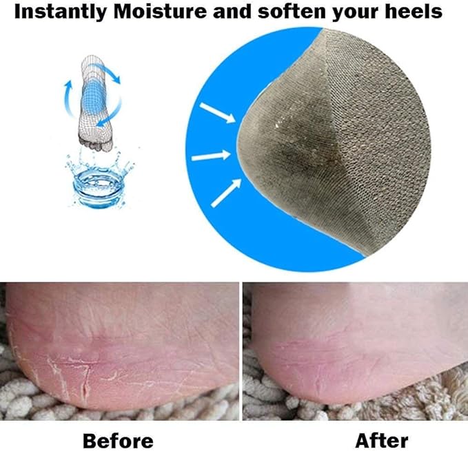 Codream Vented Moisturizing Socks Lotion Gel for Dry Cracked Heels, Spa Gel Socks Humectant Moisturizer Heel Balm Foot Treatment Care Heel Softener Compression (2 Pairs)