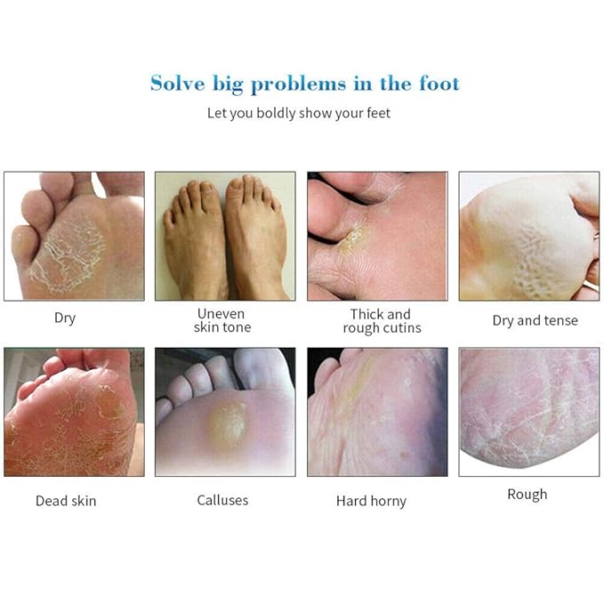 Magik Foot Peeling Mask Baby Soft Cracked Heels Remove Dead Skin Calluses (Papaya, 2 Pairs)