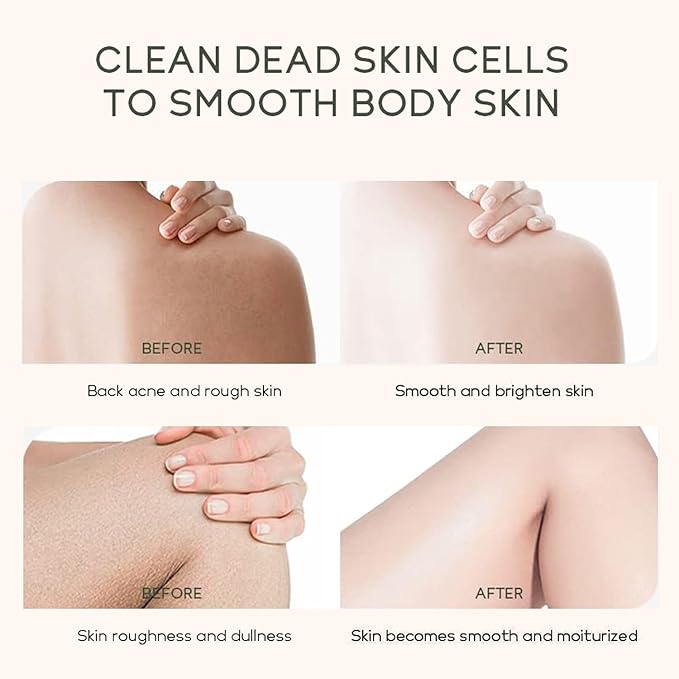 Nicotinamide Body Scrub for Blemishes, Spots, Large Pores,Repairs Skin Defects, Promotes Renewal,Deeply Hydrating, 8.8 Ounce,Body Scrub That Nourishes Skin (Nicotinamide)