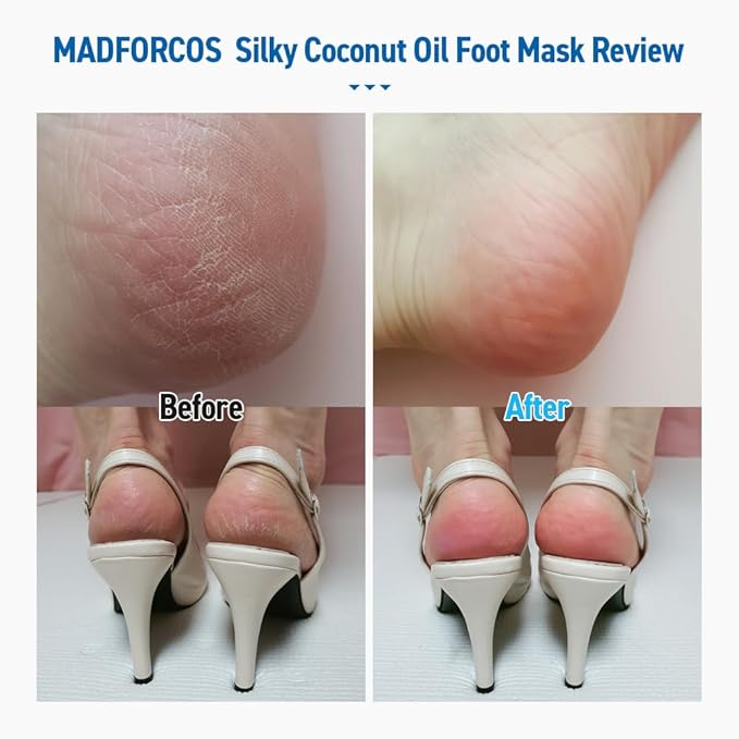 Moisturizing Foot Mask Socks Silky Coconut Oil Booties for Dry, Cracked Feet & Heels | 5 Pairs