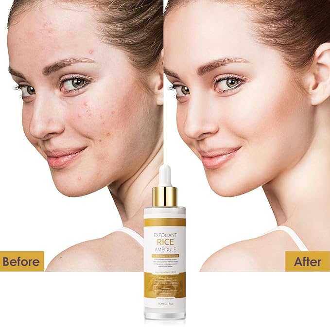 Peel Shot Glow White Rice Exfoliant Peeling Ampoule, Soft Exfoliating Face and Body Scrub, Facial Exfoliator, Deep Hydration Serum, 80ml