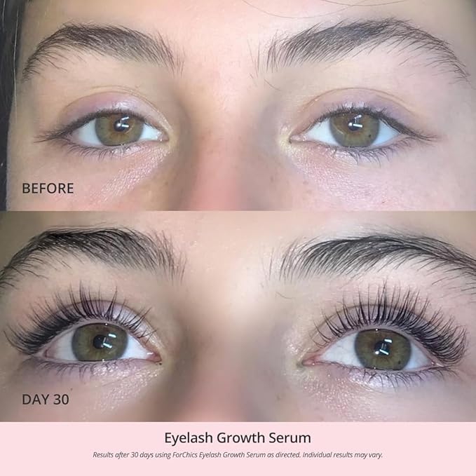 ForChics Eyelash Growth Serum - Prostaglandin-Free Lash Enhancing Serum for Longer, Thicker Lashes and Brows- Natural Formula, Visible Results in 2 Weeks - Vegan, Hormone-Free 0.10 fl. oz / 3ml