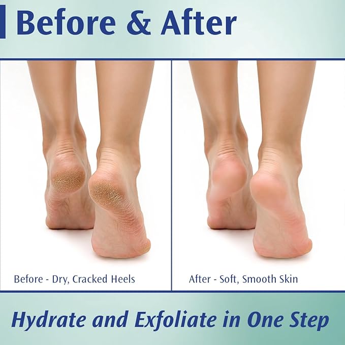 Pedifix Podiatrists' Choice 20% Urea Callus Control Extra Strength Foot Cream 4 Oz. (113g) - Professional Treatment for Dry, Cracked Feet, Callus & Foot Care Relief
