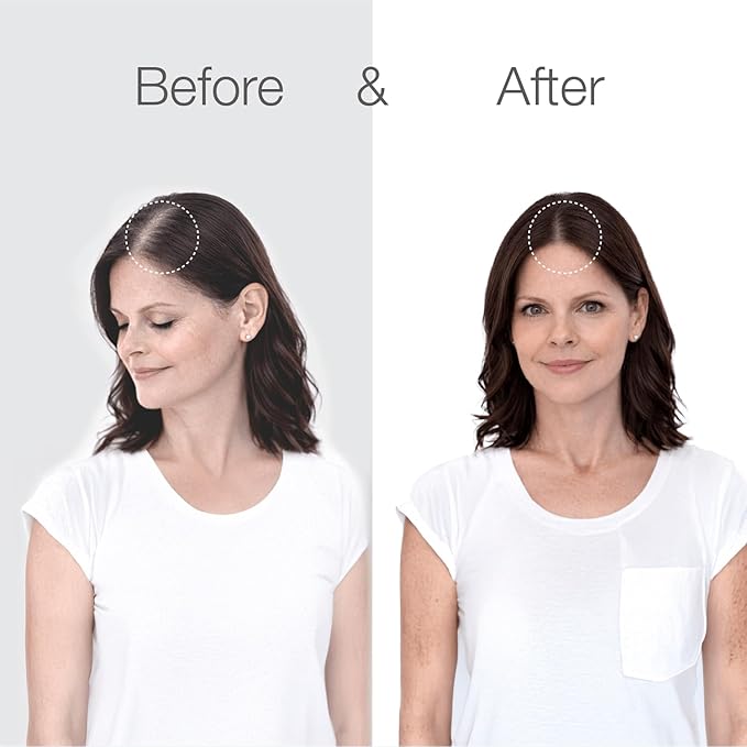 Better Not Younger Superpower+ Advanced Densifying Serum - Hair Fortifier with Biotin, Niacinamide, Rosemary & Apple Cider Vinegar for Stronger, Fuller Hair