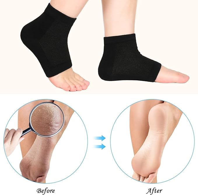3 Pairs Moisturizing Socks,Soft Ventilate Gel Heel Socks Open Toe Socks for Dry Hard Cracked Skin Moisturizing Day Night Care Skin (Black, One Size)