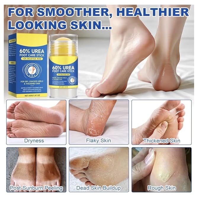 60% Urea Cream Stick with 2% Salicylic Acid, Maximum Strength Foot Care Balm, Callus Remover & Exfoliating Moisturizer for Dry Cracked Feet, Heels, Hands, Knees Elbow & Skin