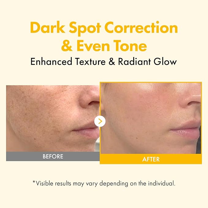 TOSOWOONG Kojic Acid Turmeric Overnight Wrapping Mask, 80% Turmeric Peel Off Facial Mask for Glass Skin, Niacinamide, Retinol & Vitamin C for Dark Spot Remover, Korean Skincare, 75 ml / 2.53 fl. oz.
