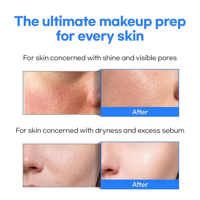 NEOGEN Dermalogy Next Glow Prep Serum 32ml, 1.08 fl.oz – Pore Care & Glass Skin Serum with Niacinamide 20,000PPM, PHA 10% + AHA 3% & 8x Hyaluronic Acid | +30.2% Makeup Adhesion | K-Beauty