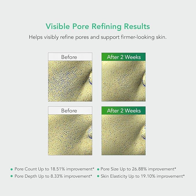 LEADERS Pore Tightening Toner Pad - Triple-Action Pore Improvement Skin Elasticity| Vegan-Certified | Clinically Proven Efficacy | Korean Skincare 50 Pads x 170ml