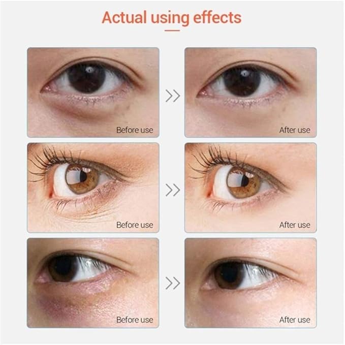 Under Eye Patches - 30 Pairs Collagen Eye Mask Eye Patches for Puffy Eyes and Dark Circles, Anti Aging Moisturizing Gel Eye Pads Under Eye Mask, Pink